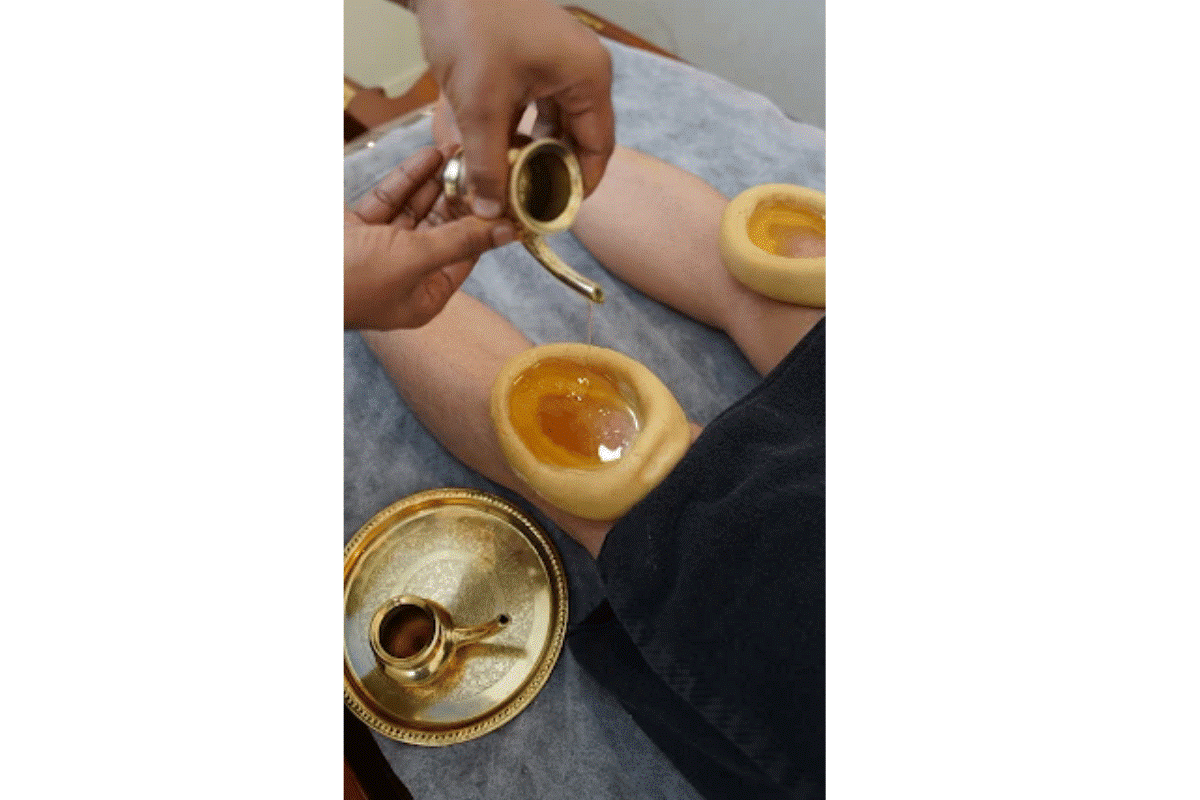Ayurvedic Knee Joint Treatment 